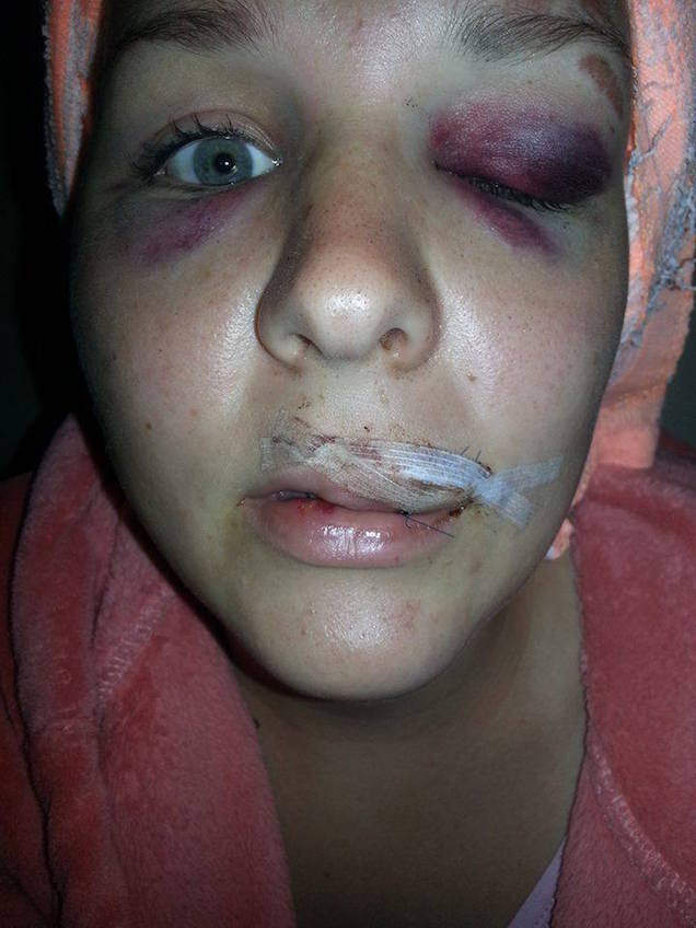 Igyekszem megmutatni, hogy az a gyenge nő, akit megvertek, igenis erős