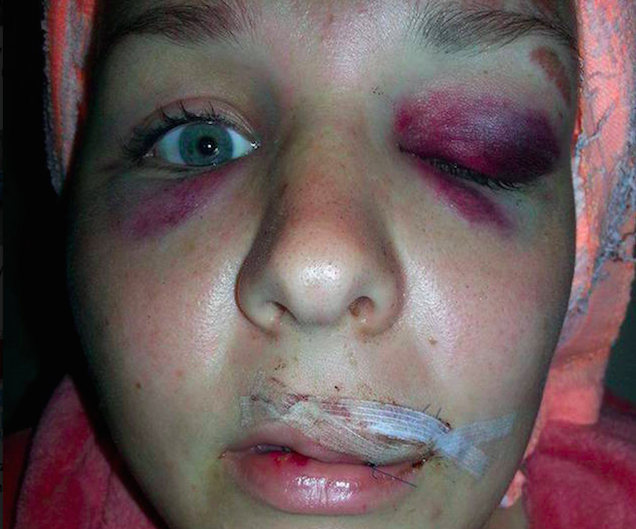 Kickboxos verte meg a szegedi lányt, előzetes letartóztatásba helyezték