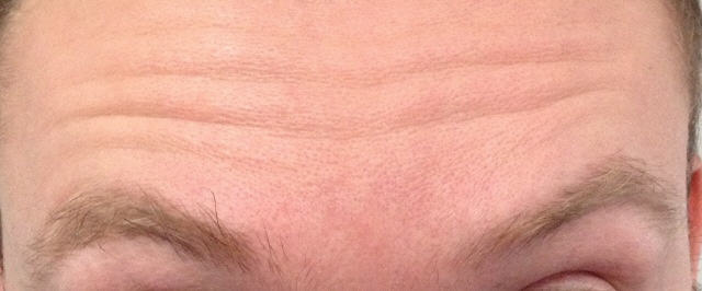 Illustration for article titled Turulmadár Orbán Viktor homlokán?