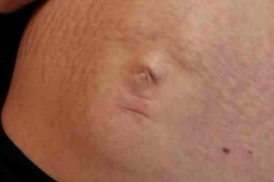 Illustration for article titled Gusztustalansági csúcsnap! - Kihívója támadt Bangó Margit kardaganatának, az anyja hasán kirajzolódó arcú magzat személyében