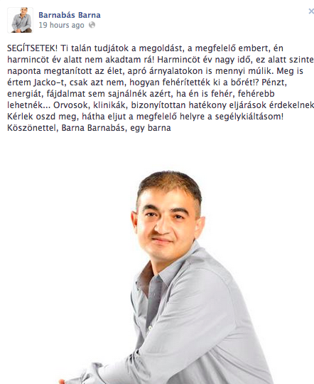 Barna Barnabás lenne a magyar Michael Jackson, de nem gyerekekkel aludna, hanem kifehéredne