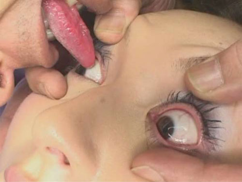 Bármennyire divatos, ne nyalogassátok partneretek szemgolyóját!