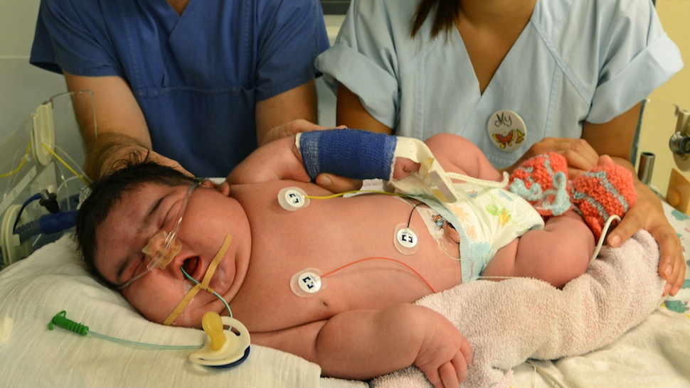 Rekordméretű óriásbébi született Németországban - fotóval!