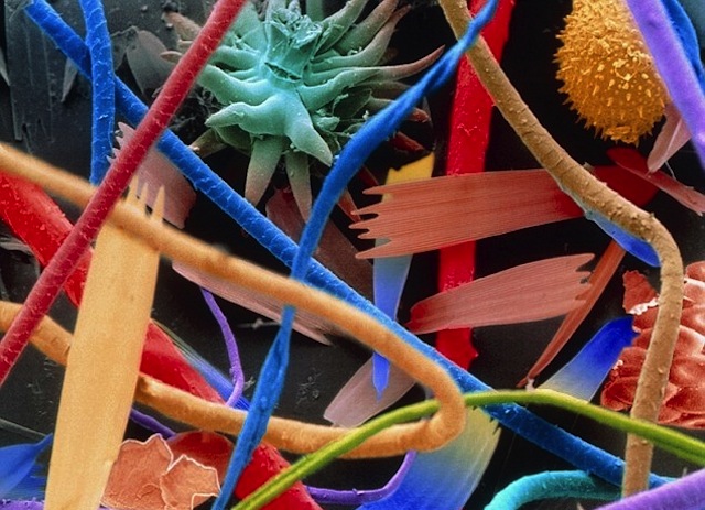 Illustration for article titled Lélegzetelállító mikroszkópos felvételek: gyönyörűek és félelmetesek