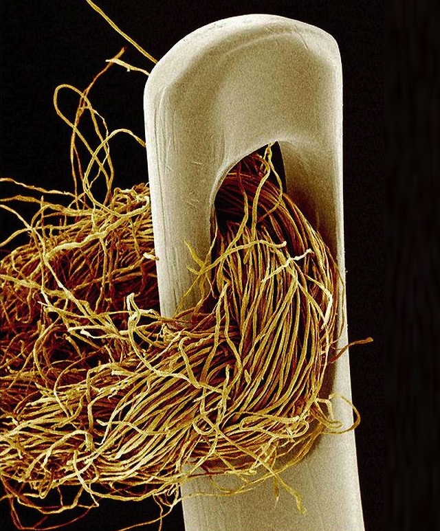 Lélegzetelállító mikroszkópos felvételek: gyönyörűek és félelmetesek