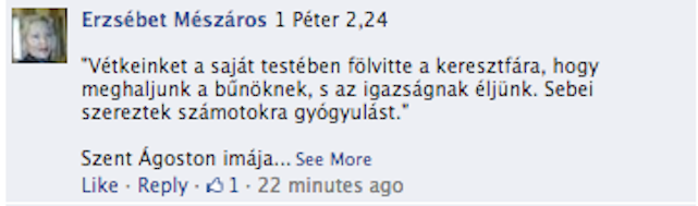 A hívei szerint nem véletlen, hogy Orbán bal lába sérült