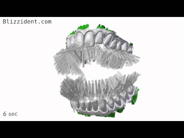 Ezzel a csodafogkefével 6 másodperc alatt moshatsz fogat