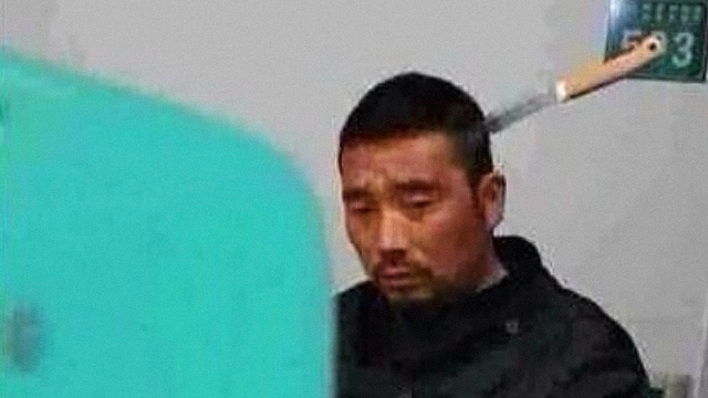 Illustration for article titled Huh ez nem halloween, egy fószer késsel a fejében sétált be a korházba