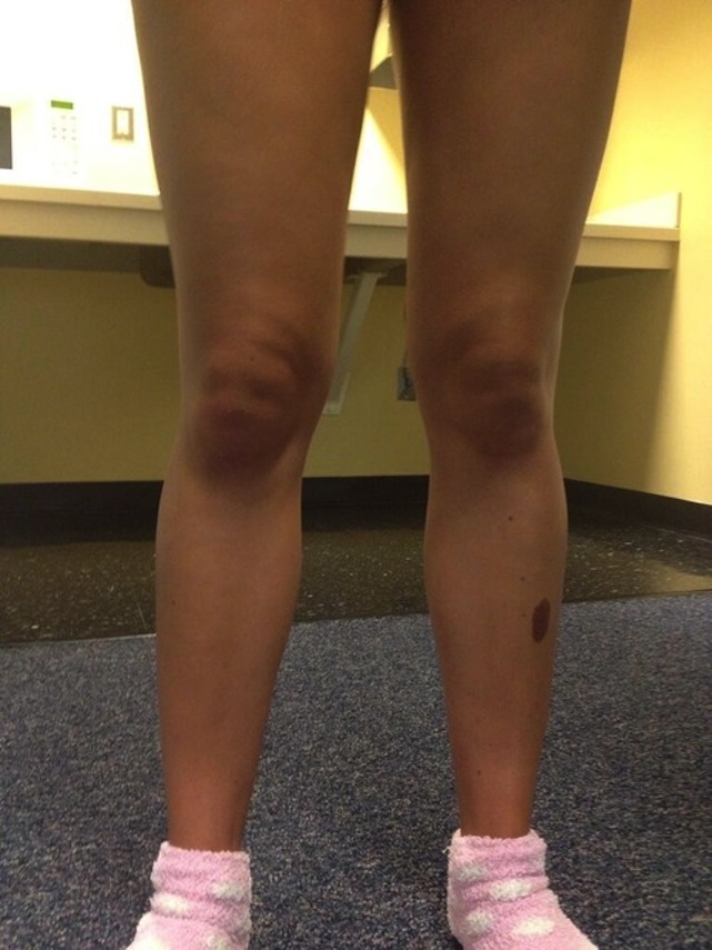 Illustration for article titled Végre nemcsak a macskák hasonlíthatnak Hitlerre