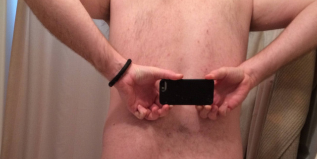 Hogy telik a kedd? Itt egy fotó a seggnélküli emberről