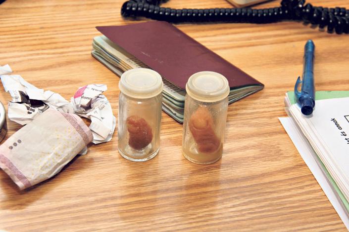 Levágott lábujjakat dugtak egy részeg angol zsebébe Budapesten