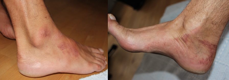 Illustration for article titled Víz alá akarta húzni a harcsa az úszó férfit