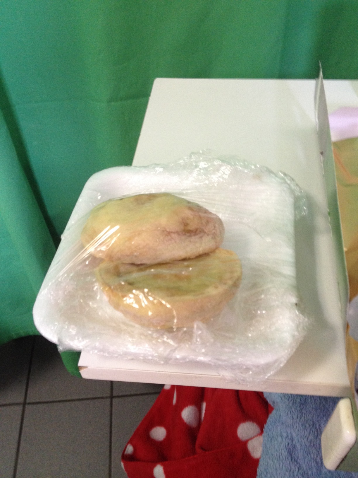 Lehet, hogy gennyes zsemlét adtak az egerszegi kardiológián