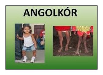 Illustration for article titled A Zika-vírus hatalmas egészségügyi kockázat, de hallottatok már a foszforállkapocsról is?