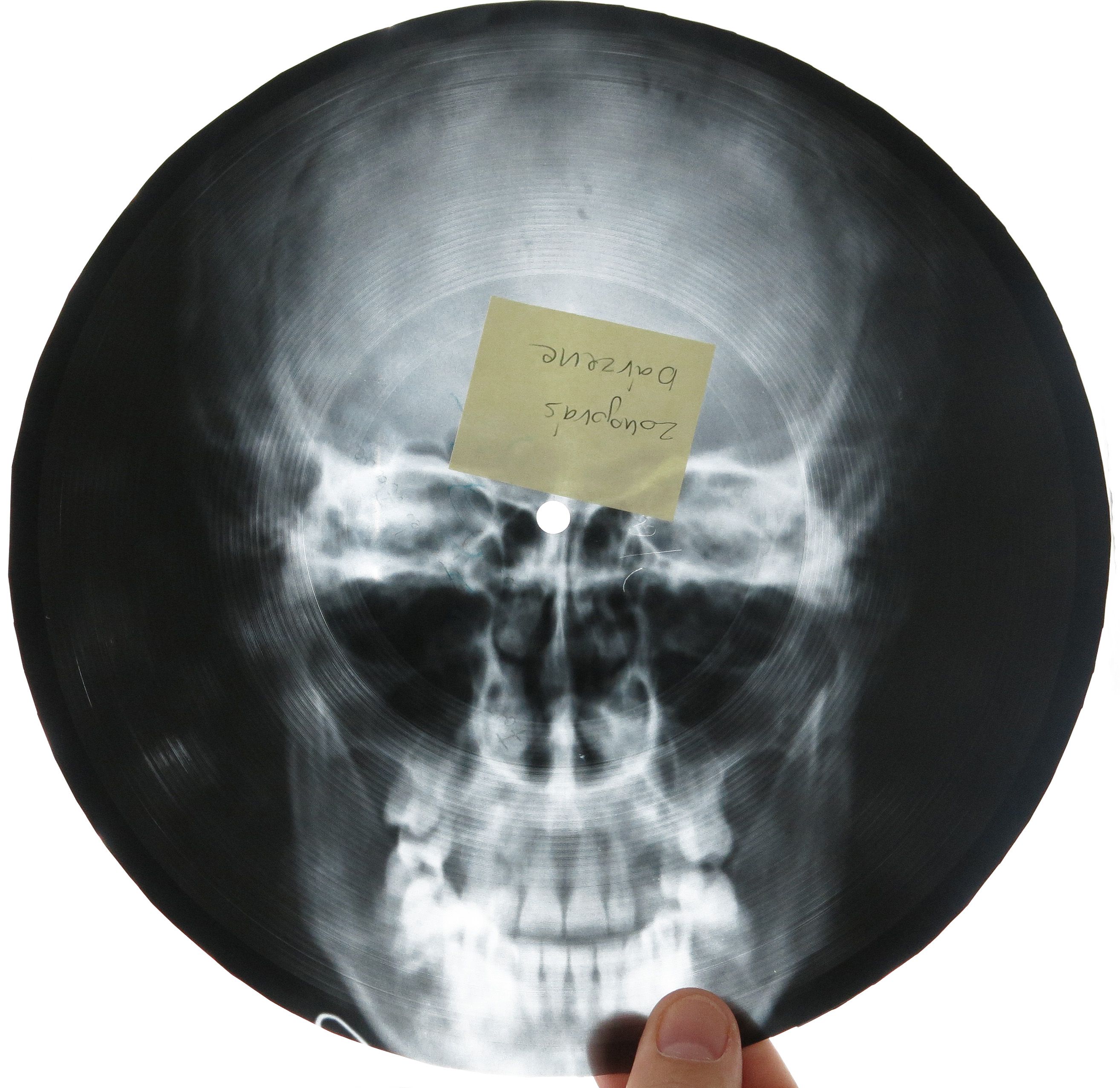 Illustration for article titled Micsoda punkság volt betiltott zenéket röntgenlemezeken terjeszteni!