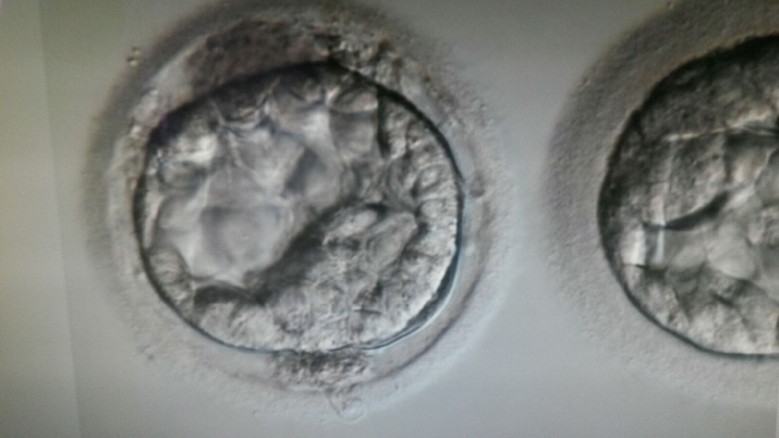 Néhány szó a lombikról.