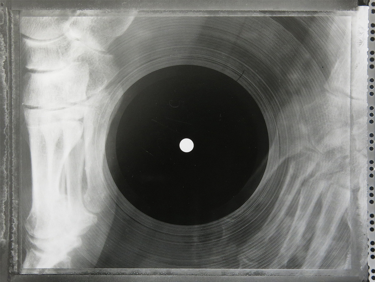 Illustration for article titled Micsoda punkság volt betiltott zenéket röntgenlemezeken terjeszteni!