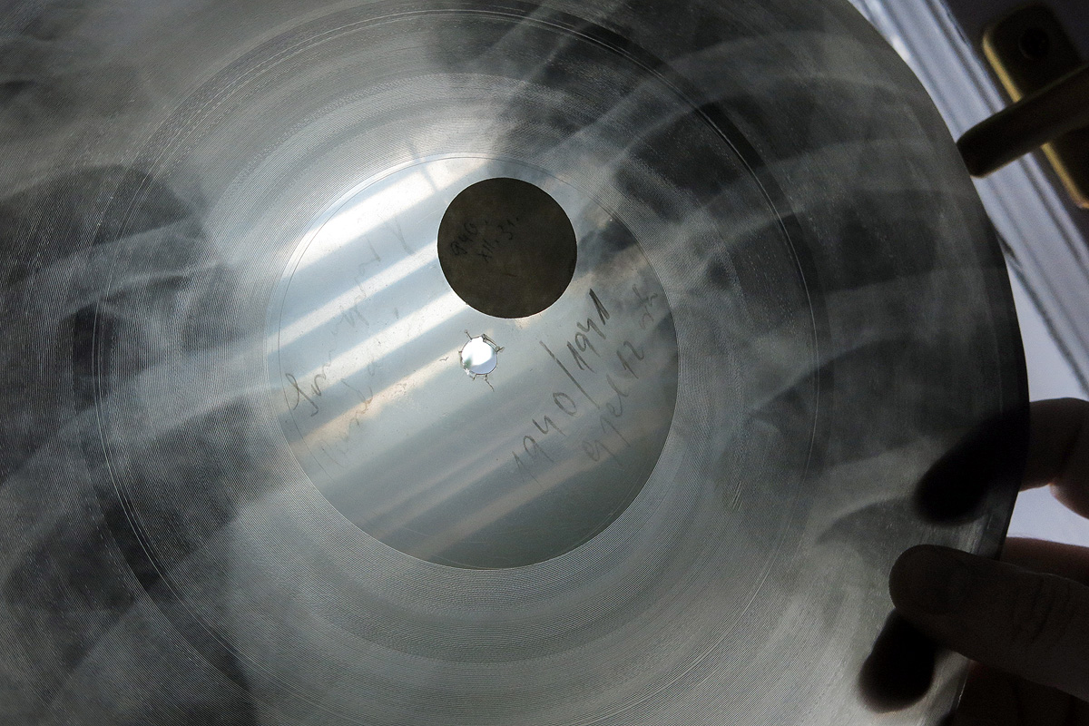 Illustration for article titled Micsoda punkság volt betiltott zenéket röntgenlemezeken terjeszteni!