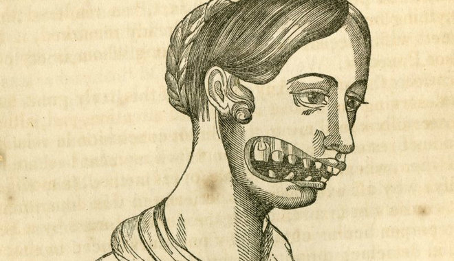 Illustration for article titled A Zika-vírus hatalmas egészségügyi kockázat, de hallottatok már a foszforállkapocsról is?