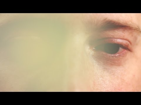 Ilyen érzés, ha az ember fokozatosan elveszti a látását