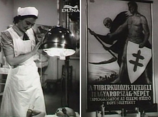 1. A kis Zorrót megkvarclámpázzák. 2. Plakát a tuberkolózisról a váróban. - jelenetek a filmből