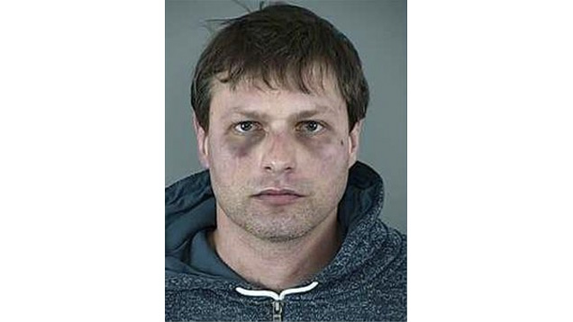 Szétverte a saját fejét, aztán rendőri brutalitásra panaszkodott