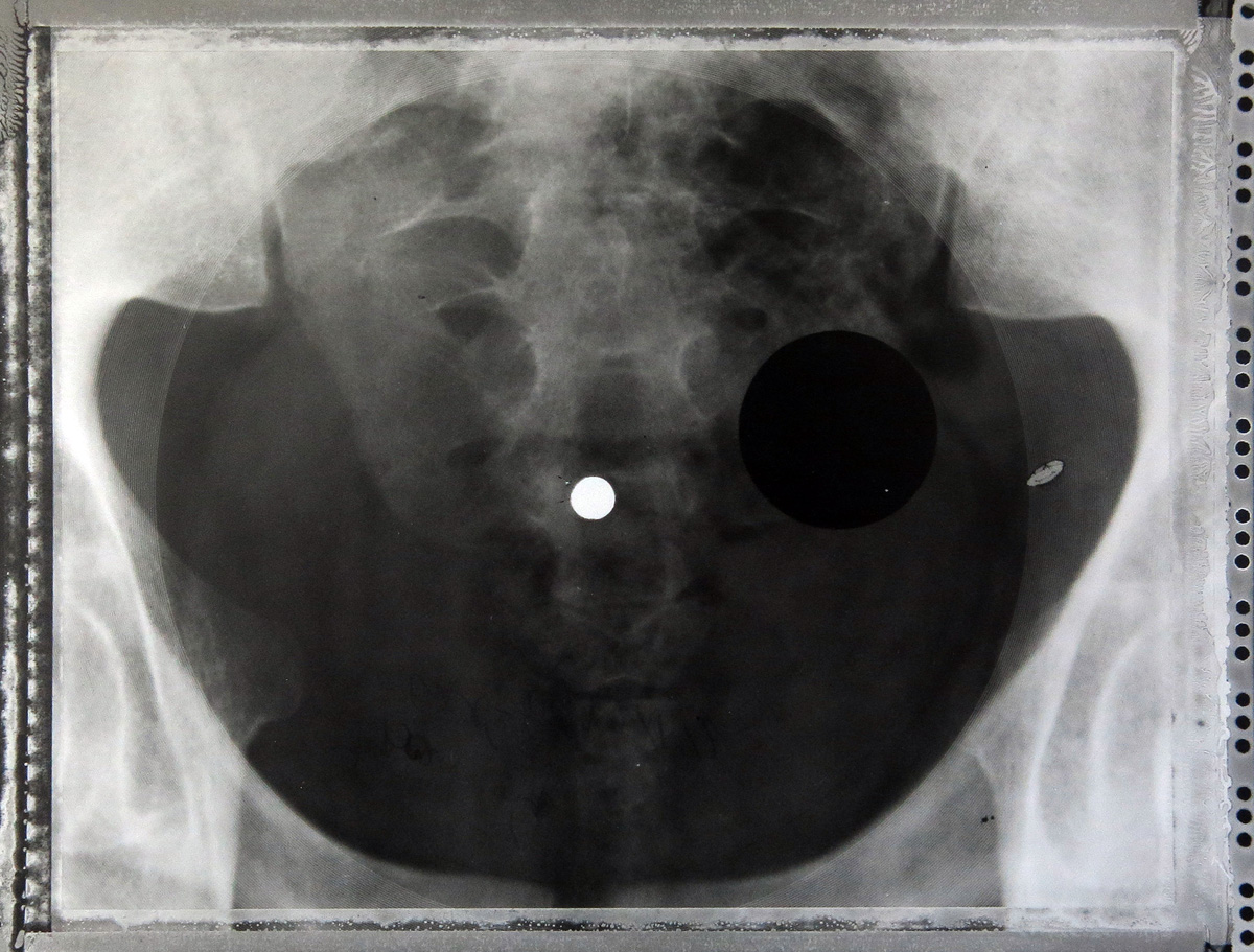 Illustration for article titled Micsoda punkság volt betiltott zenéket röntgenlemezeken terjeszteni!