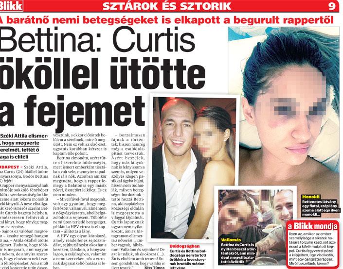 Politikai háború robbant ki Újpesten a nőverő Curtis miatt