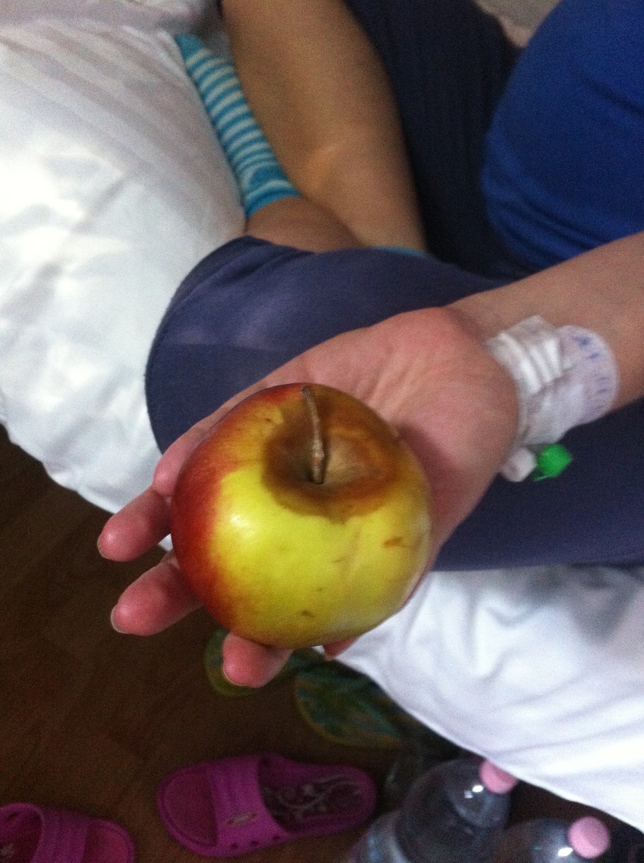 Rohadt almát adtak a Margit szülészetén uzsonnára