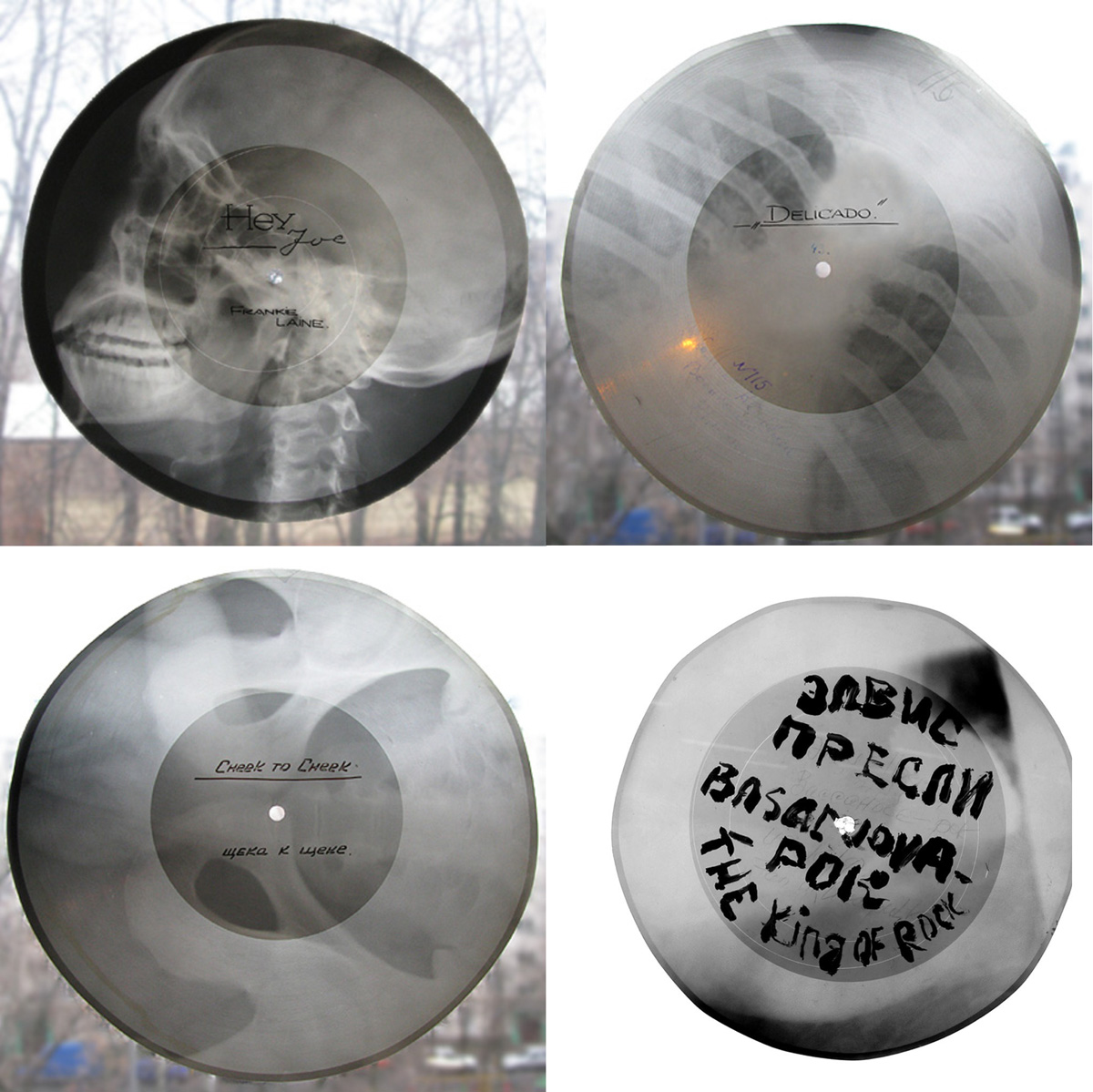 Illustration for article titled Micsoda punkság volt betiltott zenéket röntgenlemezeken terjeszteni!