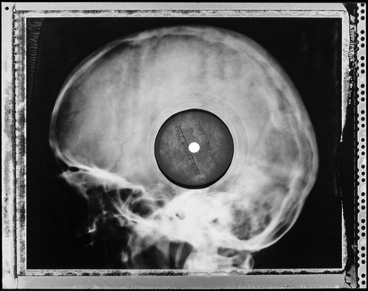 Illustration for article titled Micsoda punkság volt betiltott zenéket röntgenlemezeken terjeszteni!