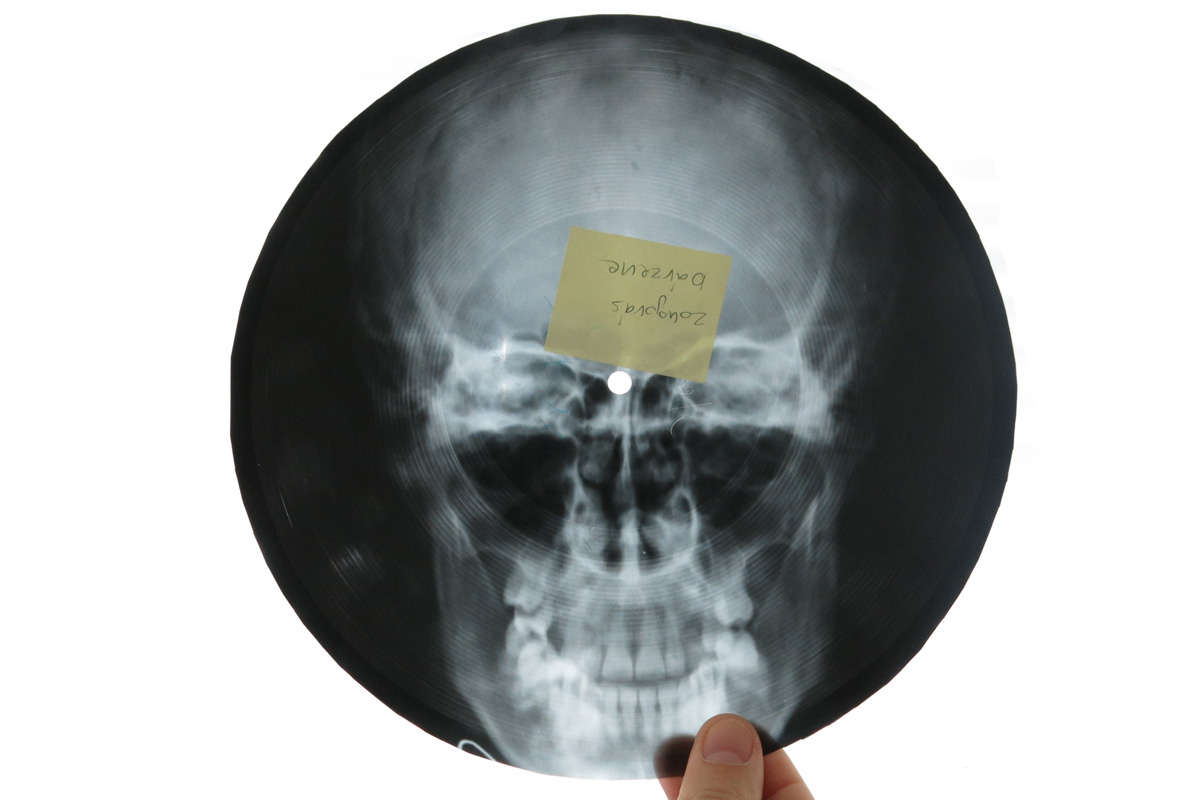 Micsoda punkság volt betiltott zenéket röntgenlemezeken terjeszteni!