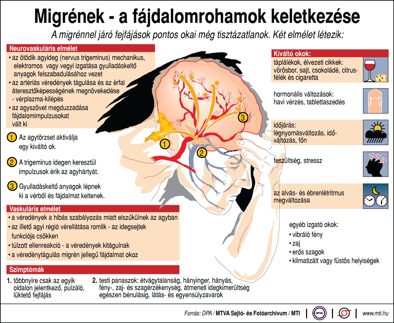 Elsőre azt hittem, ma van a fejfájás világnapja, vagy valami ilyesmi